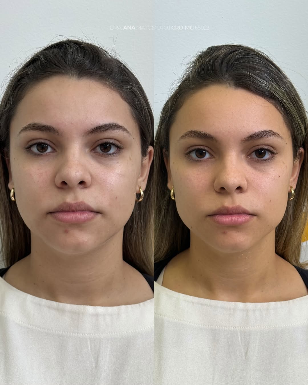 Antes e depois — caso 6